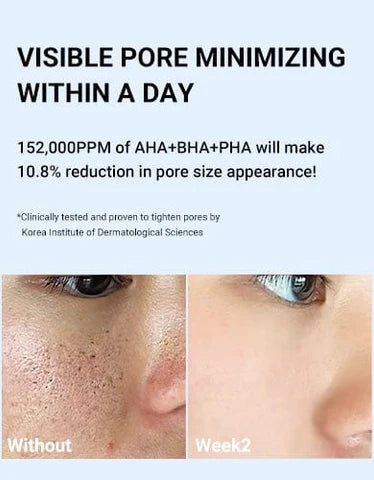 Medicube Zero Pore One-day Serum