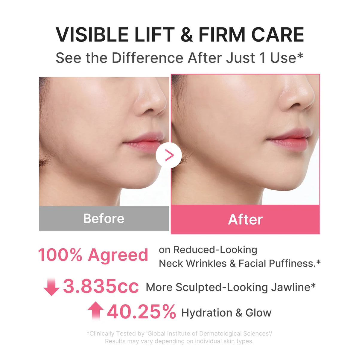 MEDICUBE – PDRN COLLAGEN GUA SHA NECK WRINKLE CREAM | 90 G