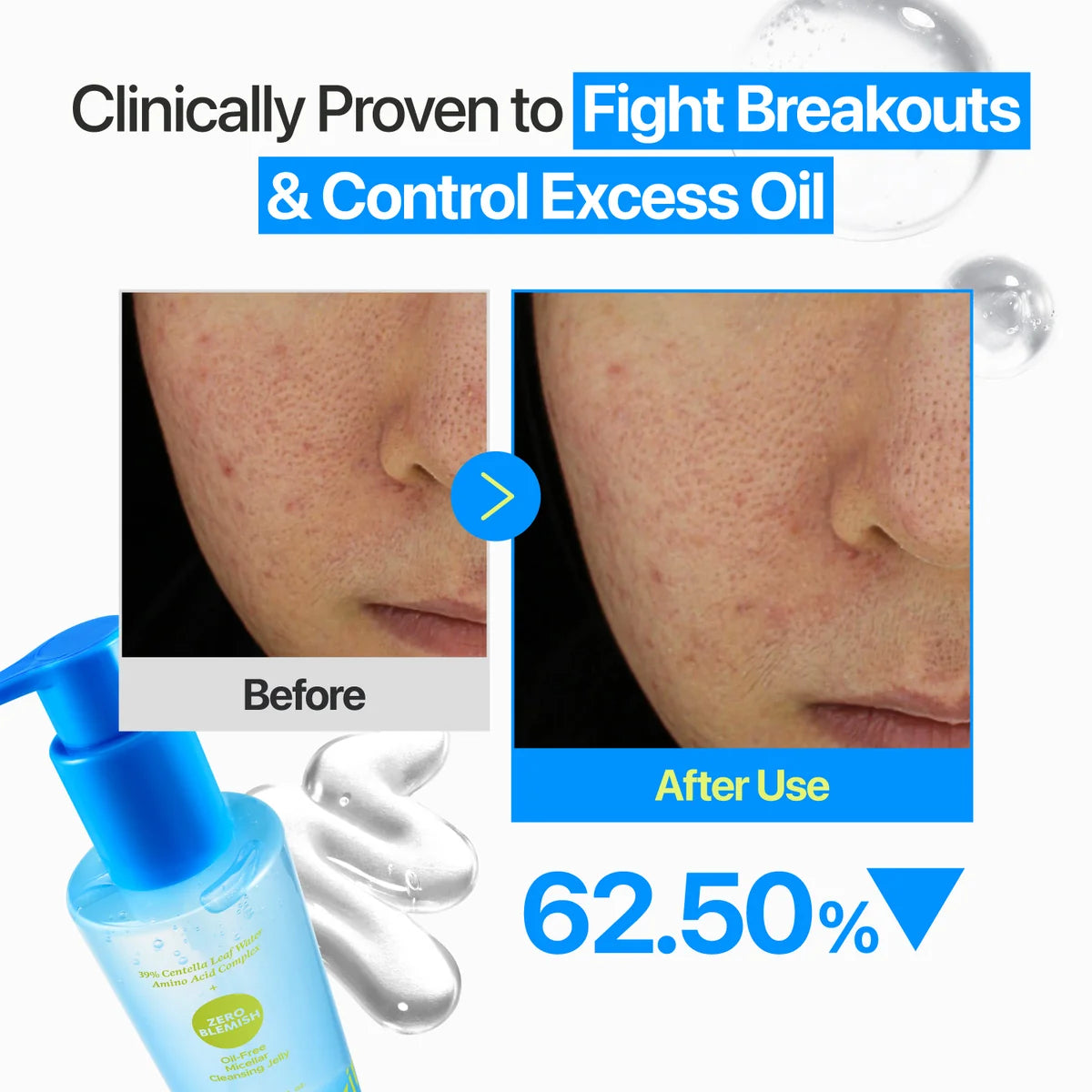 Numbuzin Zero Blemish Oil-Free Micellar Cleansing Jelly – 200 ml