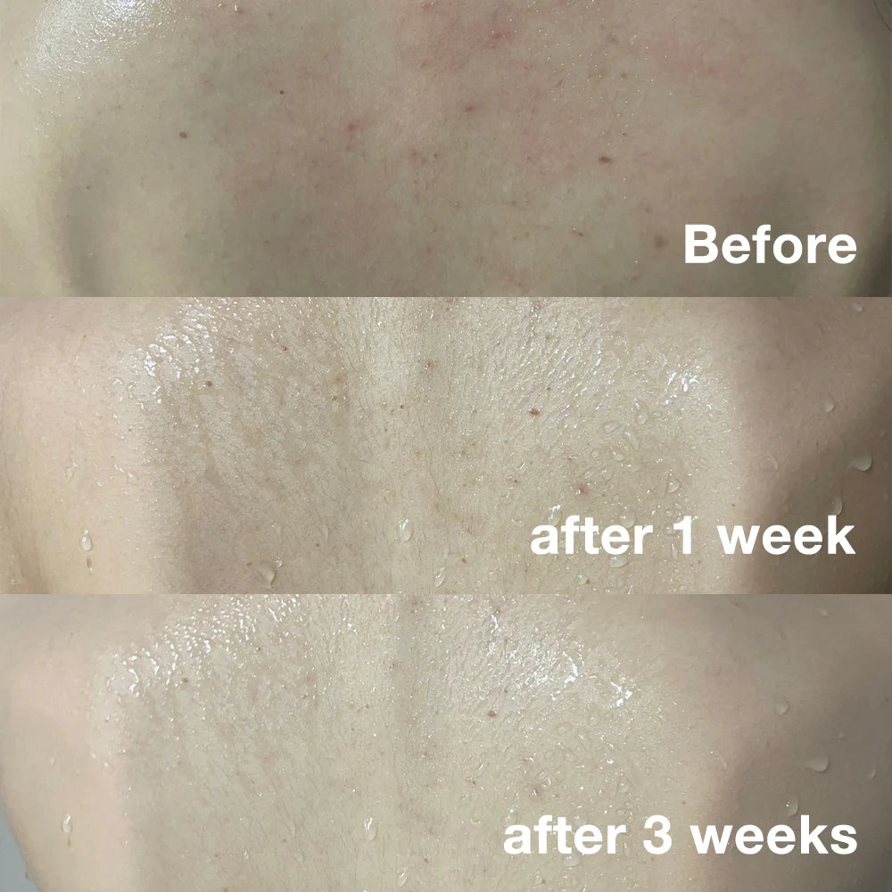 Medicube Red Body Wash